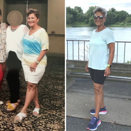 karen martini weight loss Image 4